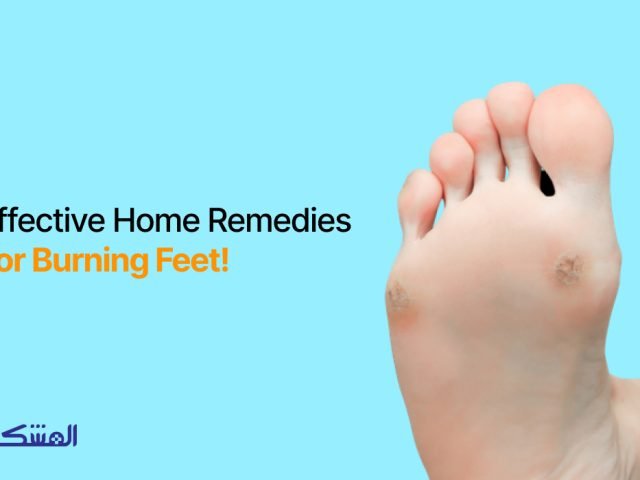 Effective home Remedies For Burning Feet